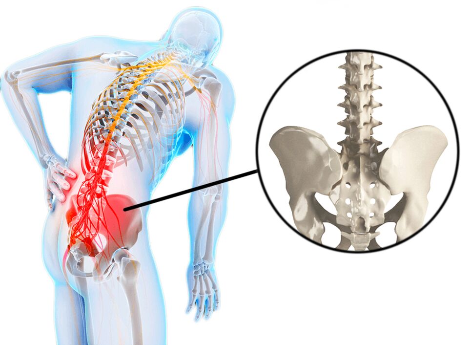 Spinal pathologies are a common cause of lower back pain