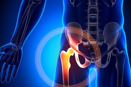 Pain in hip joint