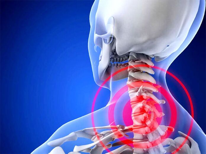 Flamed cervical region