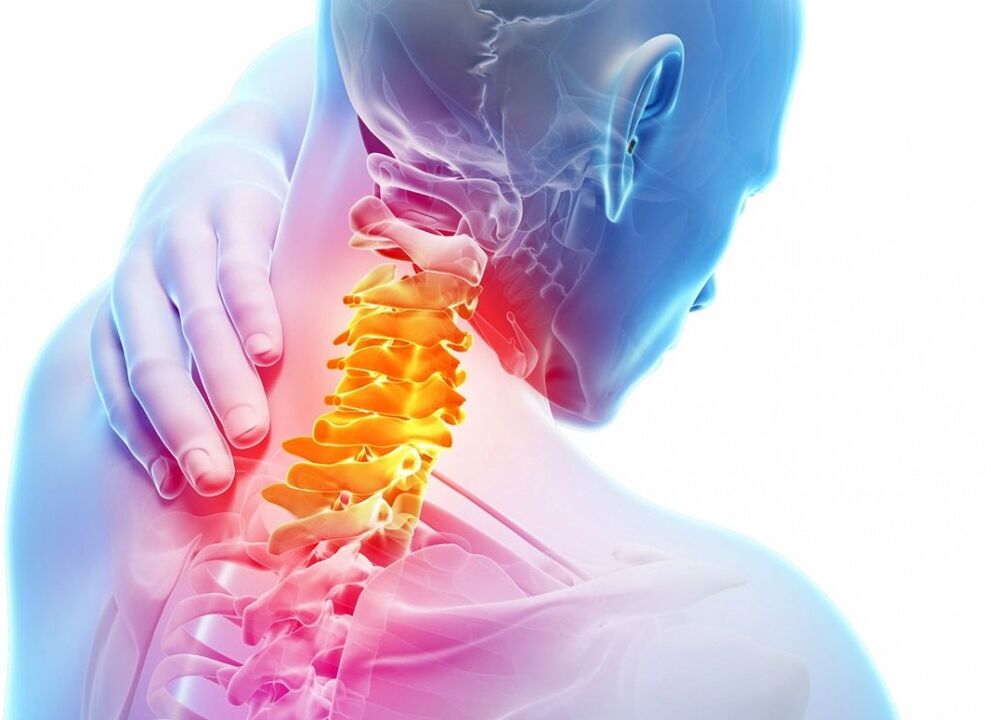 What is cervical osteochondosis