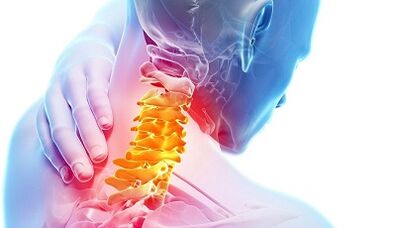 Causes of cervical osteochondosis