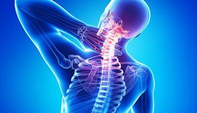 Complications of osteochondrosis of the cervical column